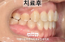 수술후
