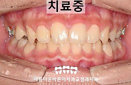 수술후