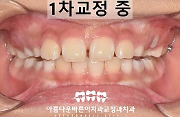 수술후