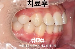 수술후
