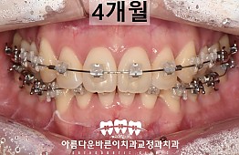 수술후