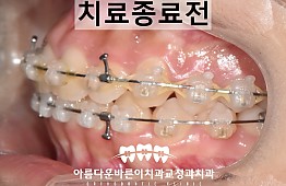 수술후