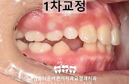 수술후