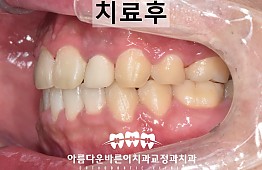 수술후