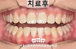 수술후