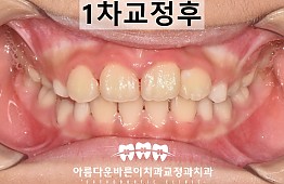 수술후