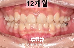 수술후