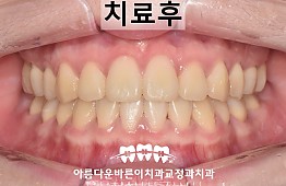 수술후