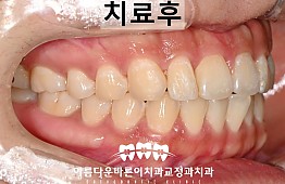 수술후