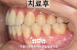 수술후