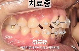수술후