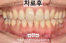 수술후