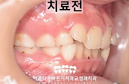 수술전