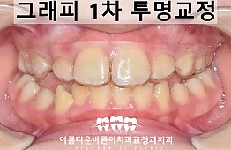 수술후