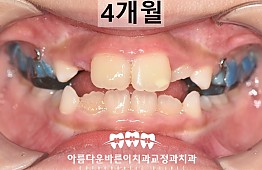 수술후