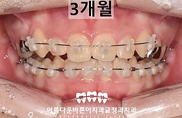 수술후