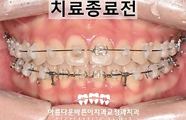 수술후