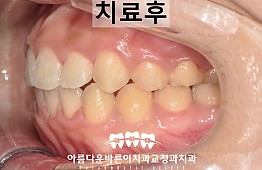 수술후