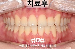 수술후