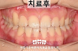 수술후