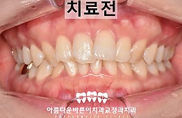 수술전