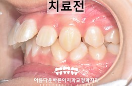 수술전