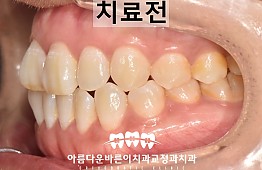 수술전