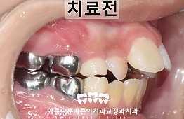 수술전