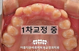 수술후