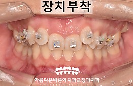 수술후