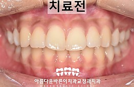 수술전
