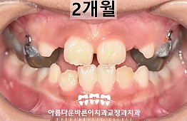 수술후