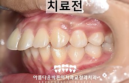 수술전