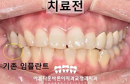 수술전