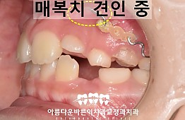 수술후