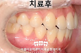 수술후
