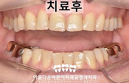 수술후