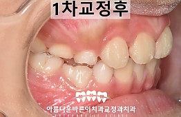 수술후