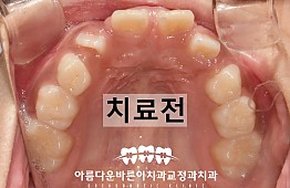 수술전