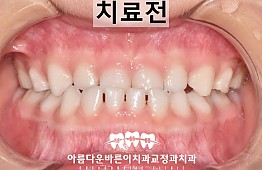 수술전