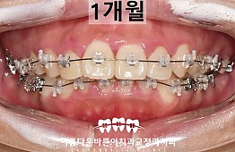 수술전