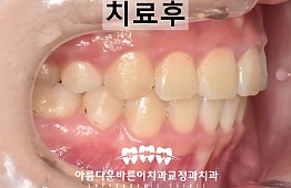 수술후