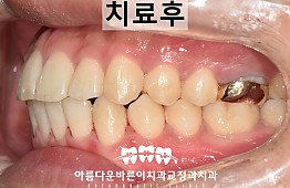 수술후