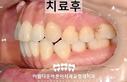 수술후