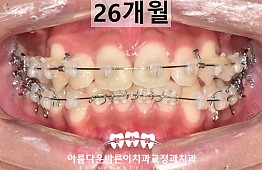 수술후