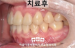 수술후