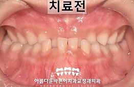 수술전