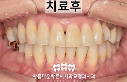 수술후