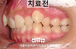 수술전
