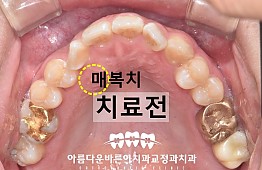 수술전